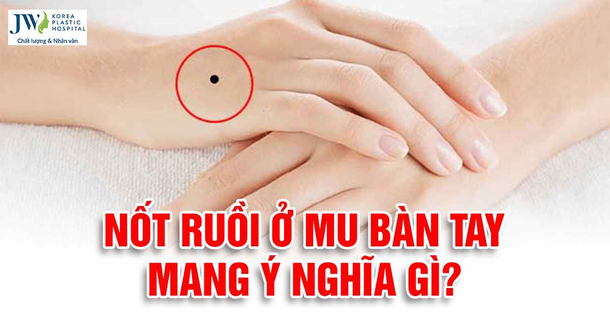 Mụn Ruồi Ở Tay Phải Nữ: Ý Nghĩa Và Điều Cần Biết Gallery 2