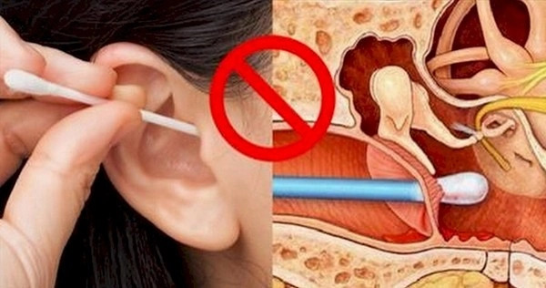 Không lấy ráy tai có sao không?