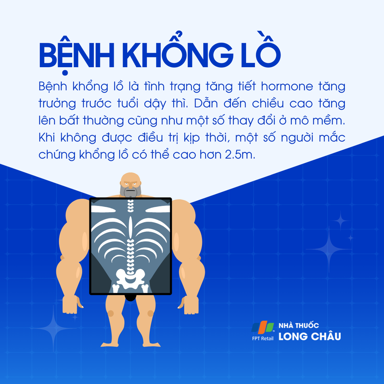 Khổng lồ là gì?