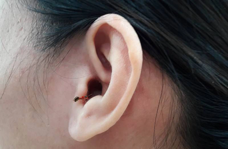 Kiến bò vào tai: Nguyên nhân, cách xử lý và phòng ngừa