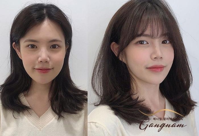 Gò má cao nên để tóc gì? Gallery 1