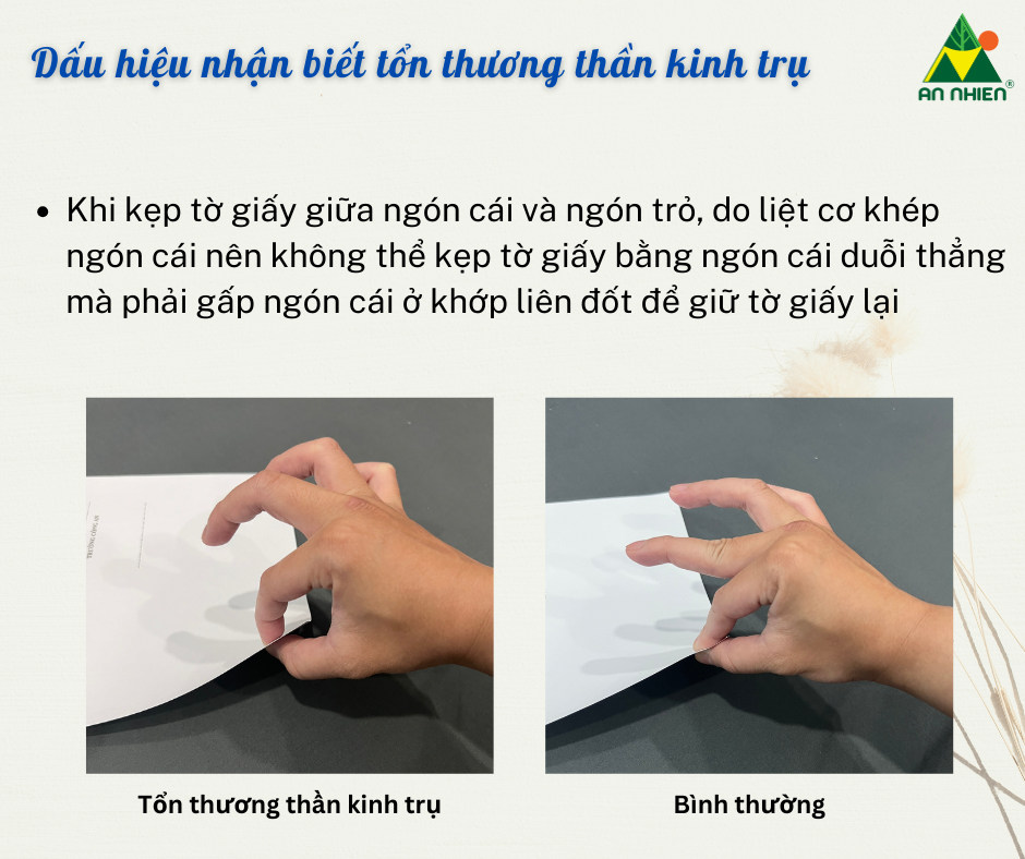 Bàn Tay Vuốt Trụ Là Gì? Gallery 1