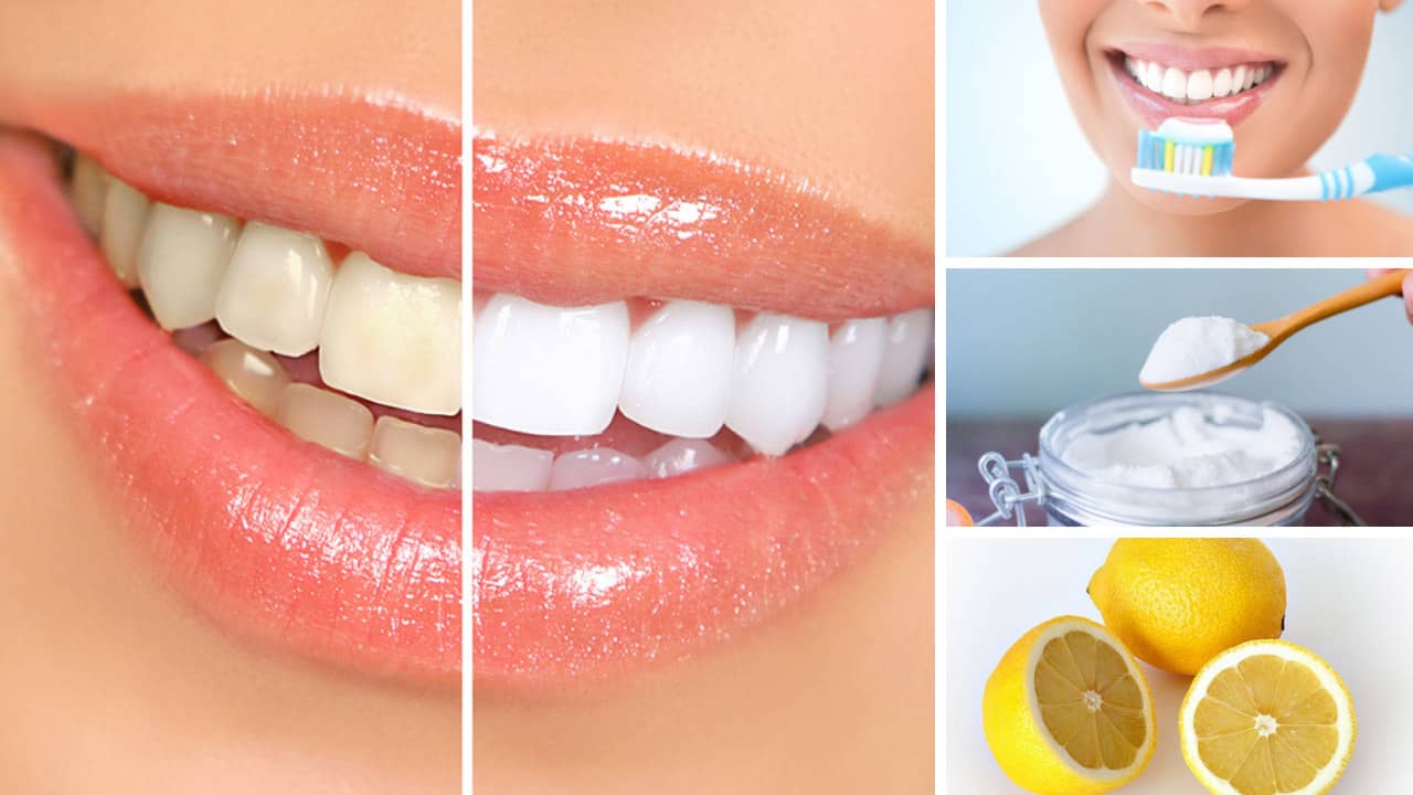 Làm Cách Nào Để Răng Trắng?