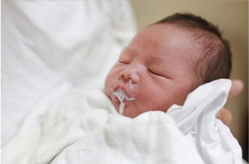 Làm gì khi trẻ bị nôn trớ nhiều?