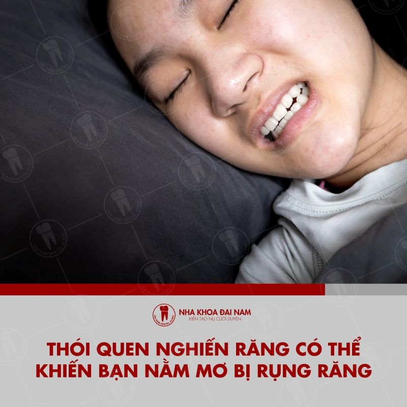 Mơ Ngủ Gãy Răng: Điềm Báo Hay Ngẫu Nhiên? Gallery 2