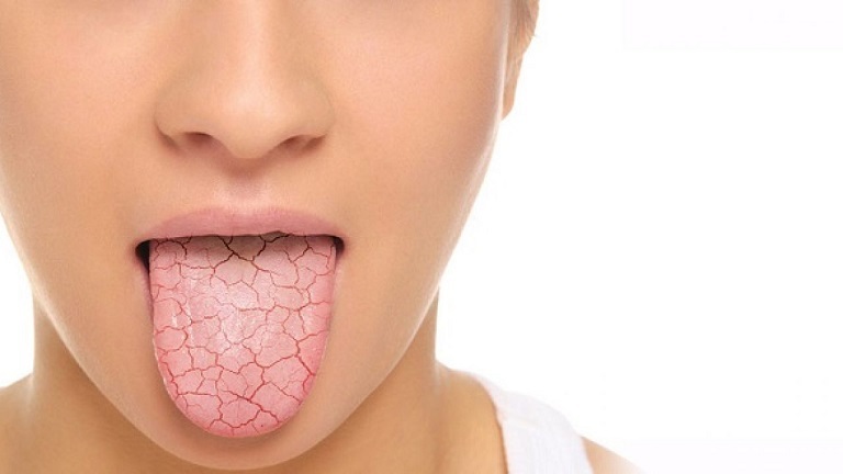 Làm Sao Để Hết Đắng Miệng Khi Ốm?