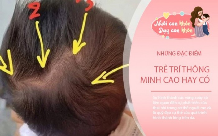 Trẻ 2 Xoáy Bướng Bỉnh Hay Thông Minh? Gallery 2