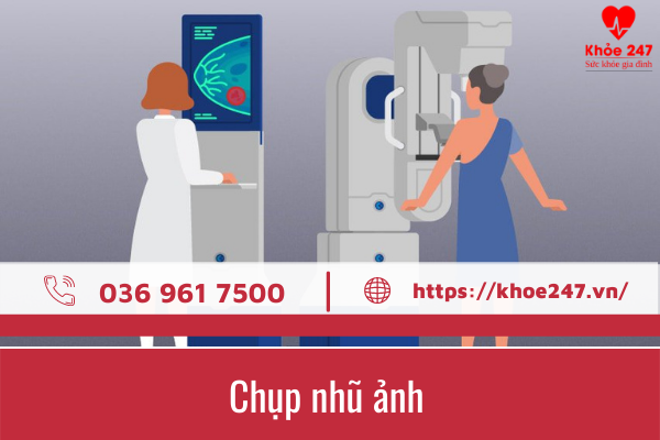 Chụp Nhũ Ảnh Bao Nhiêu Tiền? Gallery 2