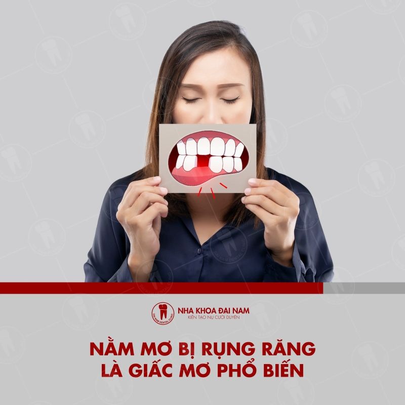 Mơ Rụng Nhiều Răng Gallery 2