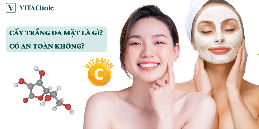 Cấy trắng da mặt được bao lâu? Gallery 2