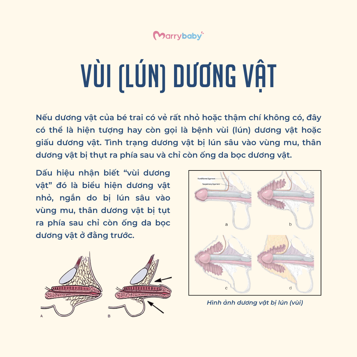 Anh Con Trai Rất Tự Nhiên Gallery 2