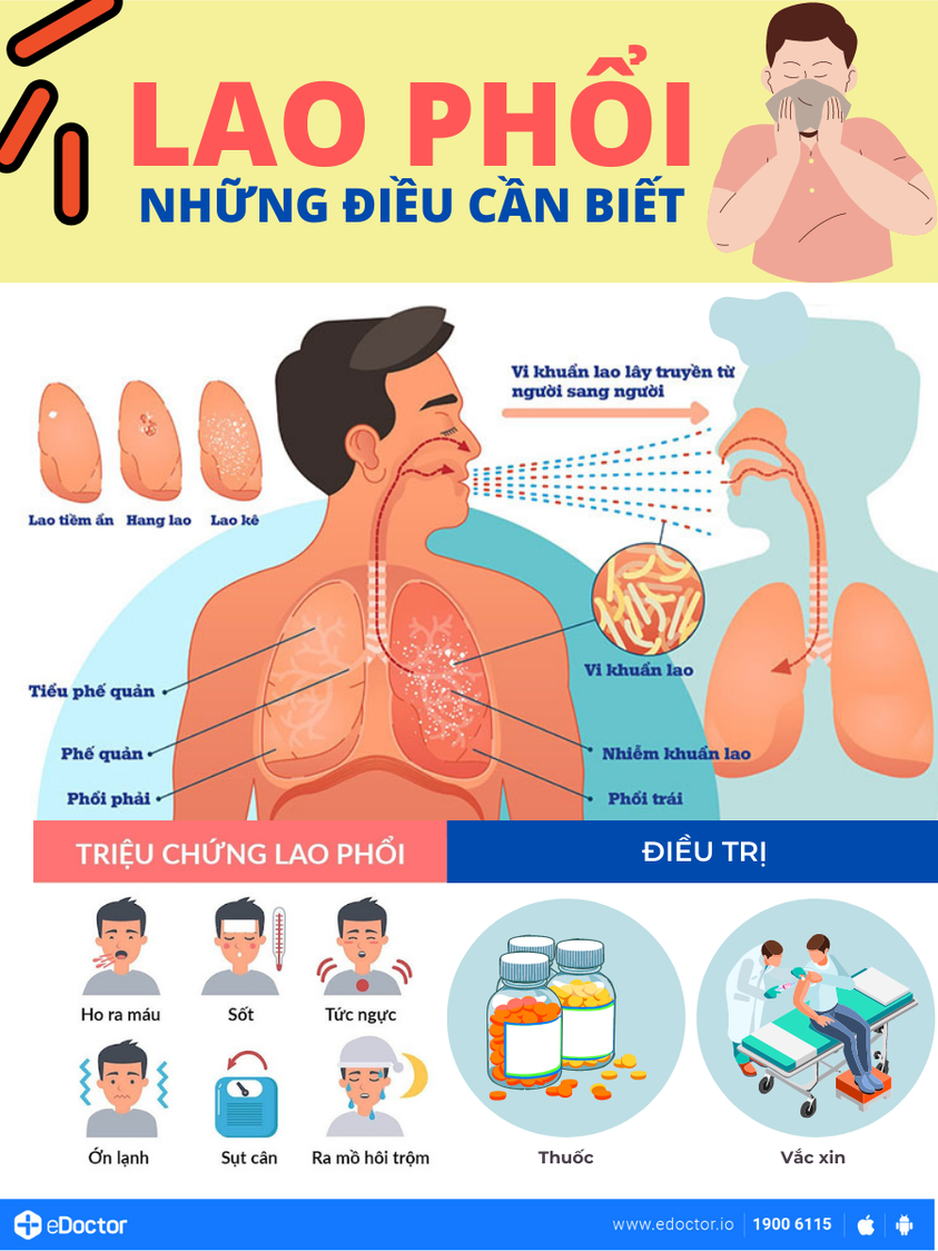 Lao phổi có lây không? Gallery 2