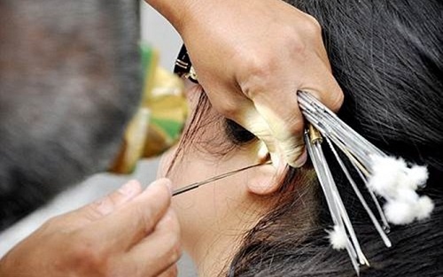 Lấy ráy tai nữ: An toàn và hiệu quả