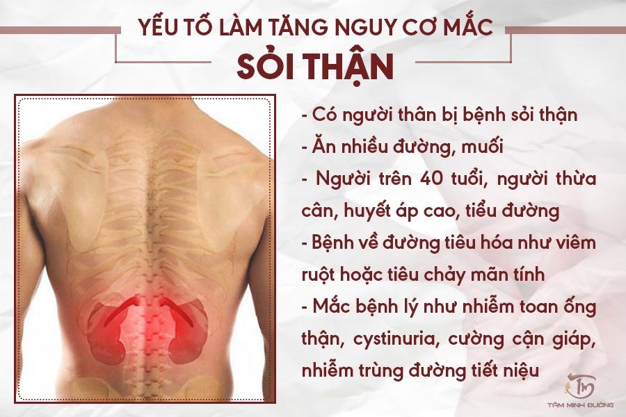 Nguyên Nhân Gây Sỏi Thận: Giải Đáp Thắc Mắc Của Bạn