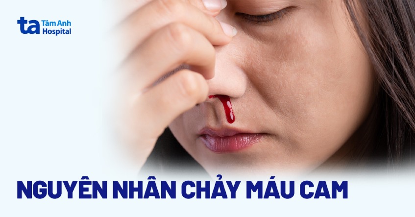 Lí do chảy máu mũi