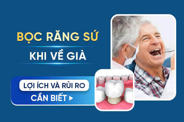 Răng Sứ Khi Về Già: Giữ Nụ Cười Rạng Rỡ Tuổi Tàn Gallery 1