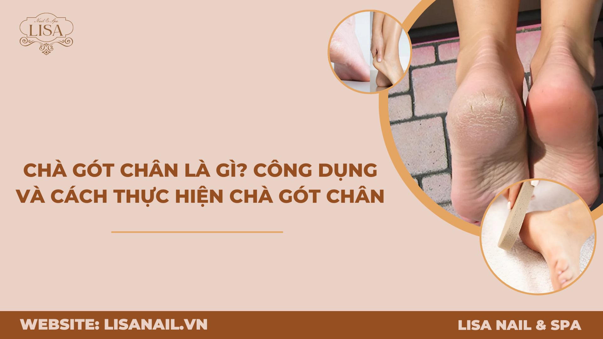 Chà gót chân có tốt không? Gallery 1