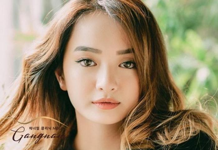 Cằm tròn đầy đặn: Bí quyết sở hữu khuôn mặt xinh đẹp và phúc hậu Gallery 1