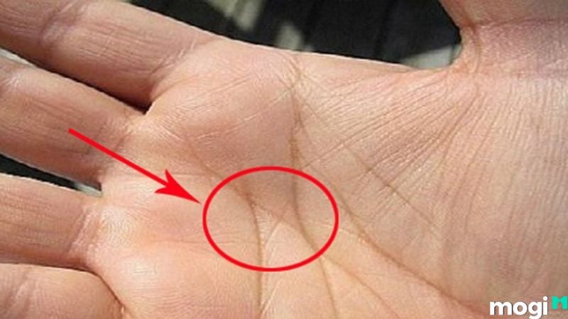 Lòng bàn tay có dấu X: Ý nghĩa và giải đáp Gallery 2