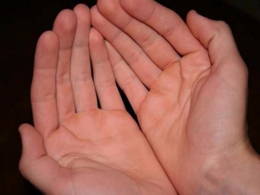 Lòng bàn tay hồng hào đầy đặn: Dấu hiệu của sức khỏe hay bệnh tật?