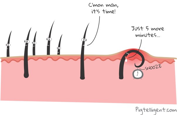 Lông Chân Bị Cuộn Tròn: Nguyên Nhân Và Cách Khắc Phục