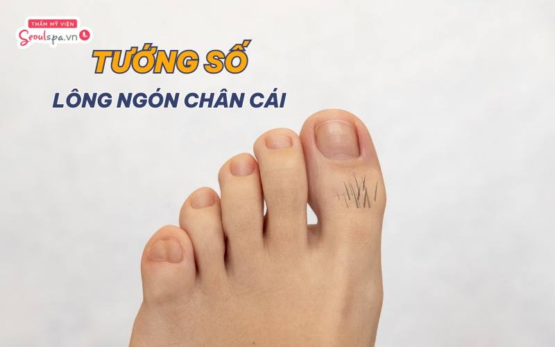 Lông ở Ngón Chân Cái Gallery 2