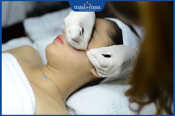 Nặn Mụn Bằng Tăm Bông: Có Nên Hay Không? Gallery 2