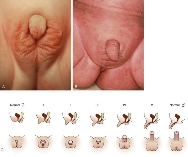 Lưỡng tính là gì?