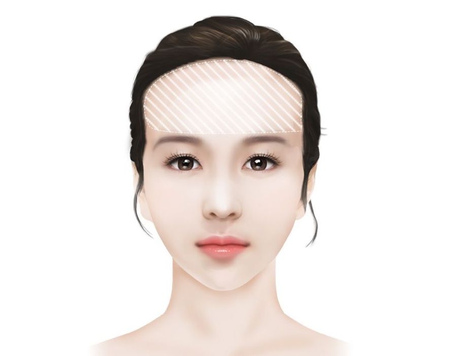 Trán dô nên để tóc gì? Gallery 2