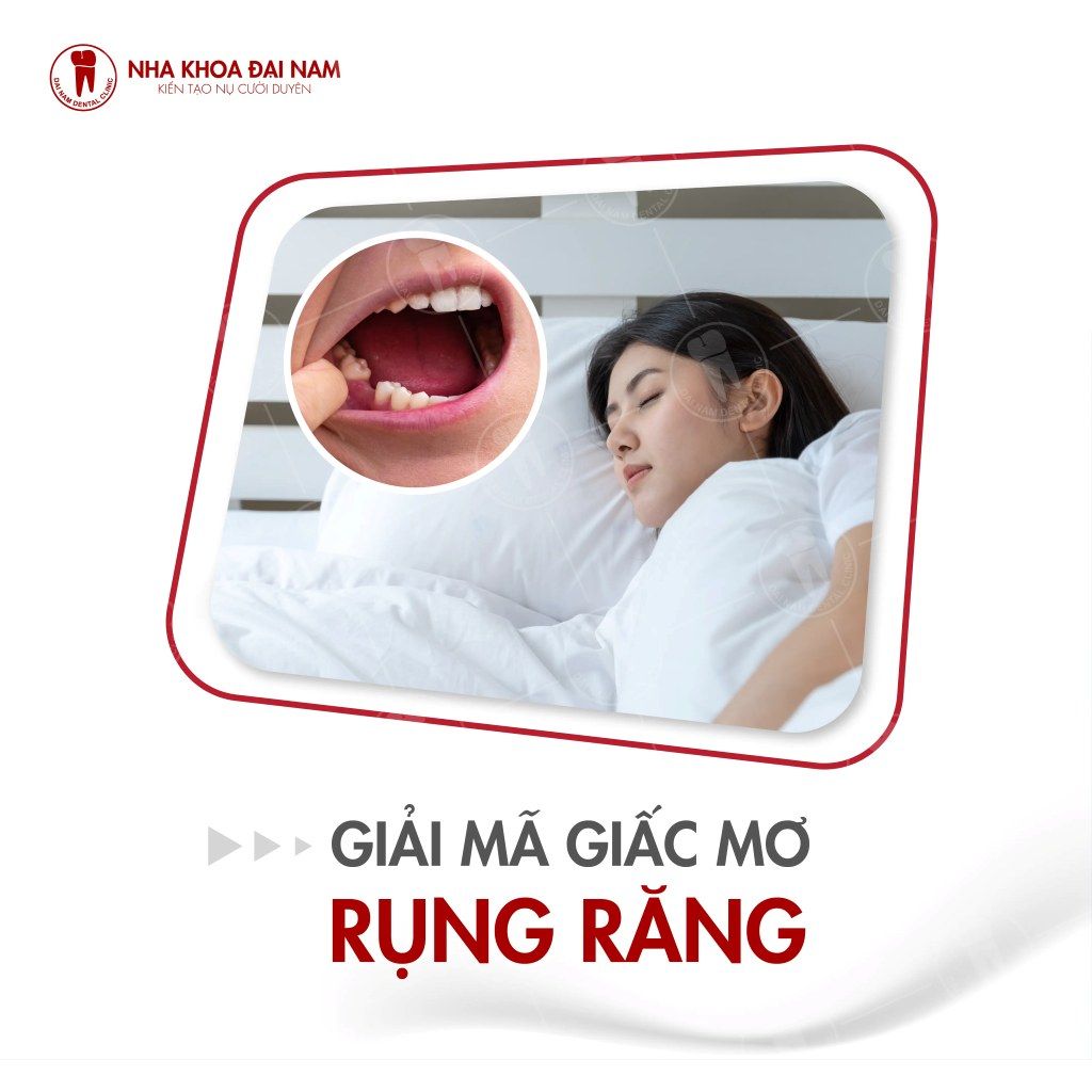 Nằm Mơ Rụng 1 Cái Răng Đánh Đề Con Gì? Gallery 2