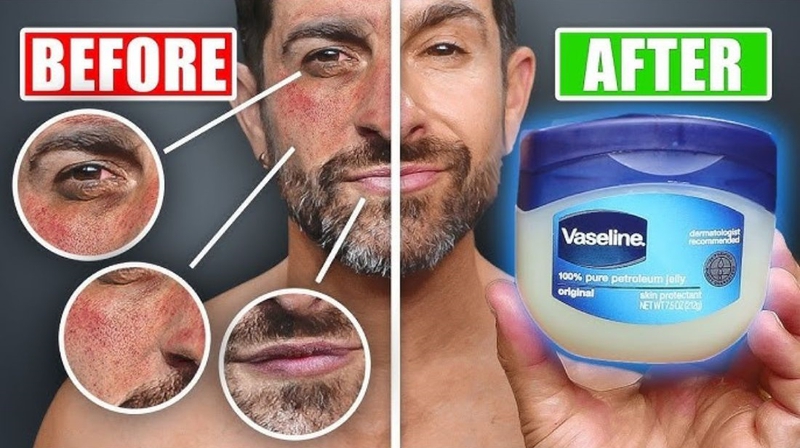 Vaseline Có Tác Dụng Gì Cho Da Mặt? Gallery 2