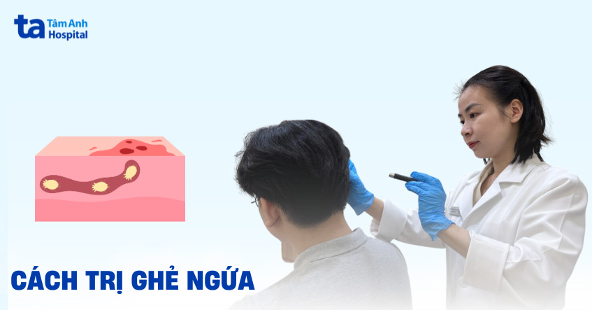 Cách Chữa Ghẻ Tại Nhà Gallery 2