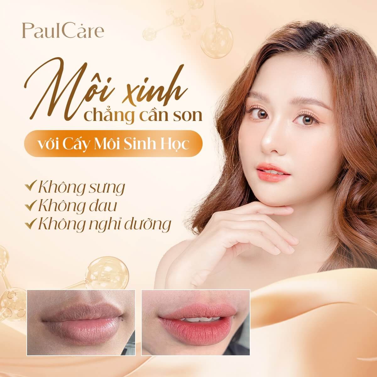 Cấy môi sinh học ở đâu tốt? Gallery 2