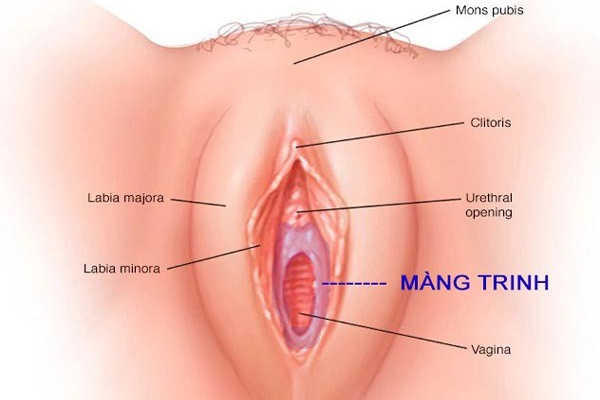 Màng trinh có lành lại được không?