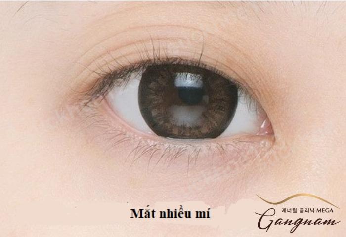 Mát Mát Là Gì? Gallery 1