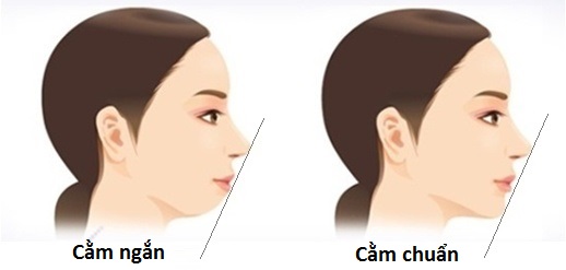 Mặt Tròn Cằm Ngắn: Hướng Dẫn Chọn Kiểu Tóc và Trang Điểm Phù Hợp