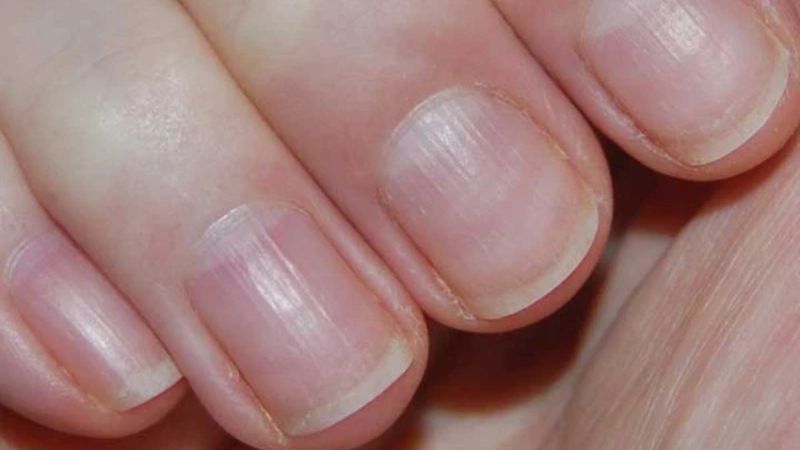 Màu sắc móng tay nói lên điều gì?