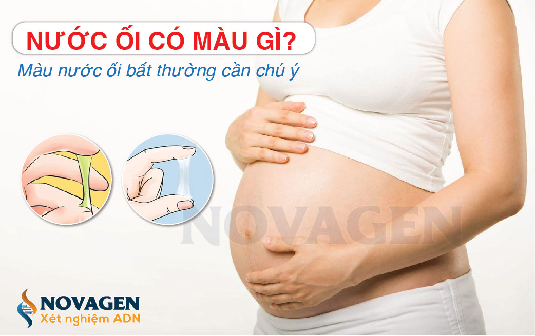 Nước ối sắp sinh có màu gì? Gallery 2