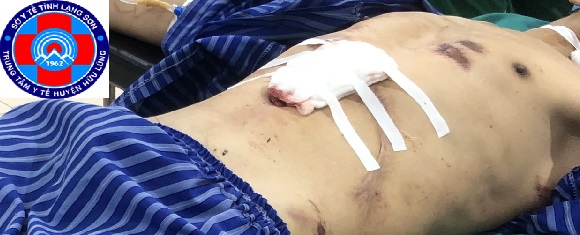 Mơ bị đâm vào bụng: Giải mã giấc mơ và ý nghĩa tâm linh