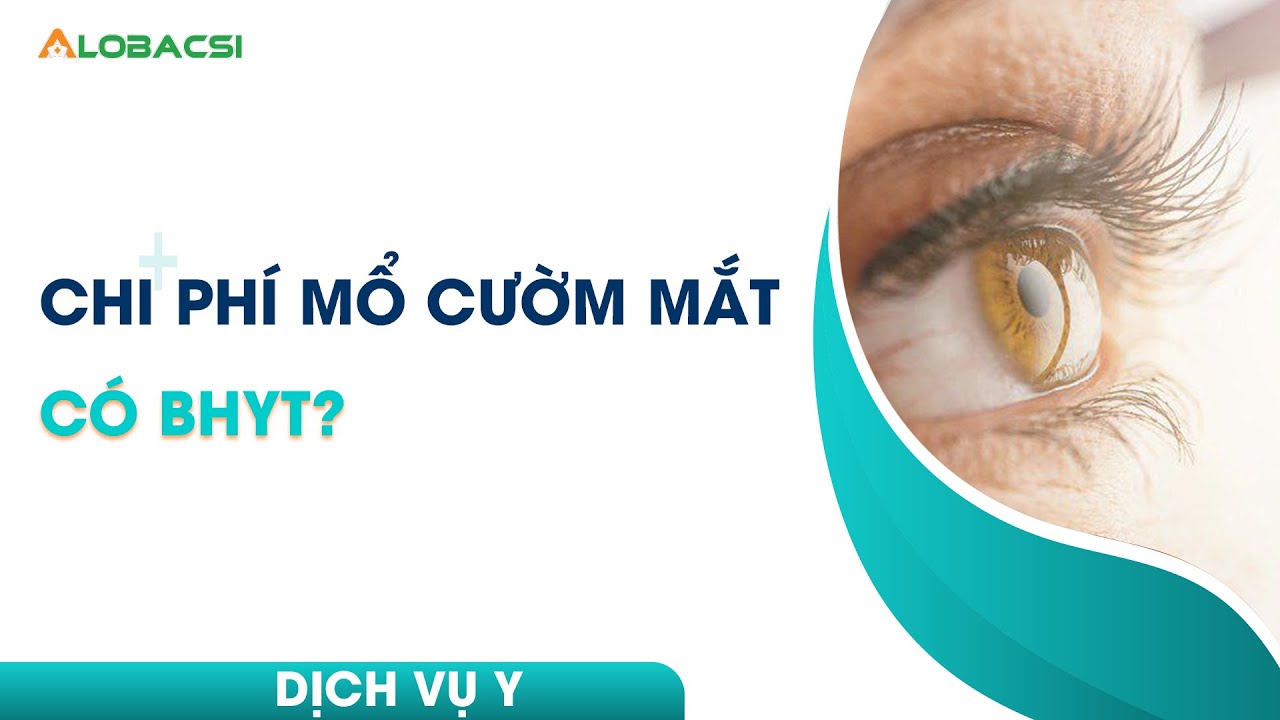 Mổ cườm nước bao nhiêu tiền? Gallery 2