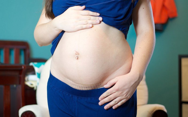 Mổ đẻ lần 2 nên mổ ở tuần bao nhiêu?