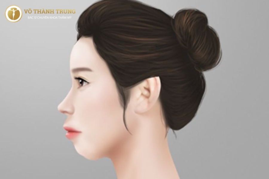 Mỏ nhọn phải làm sao?