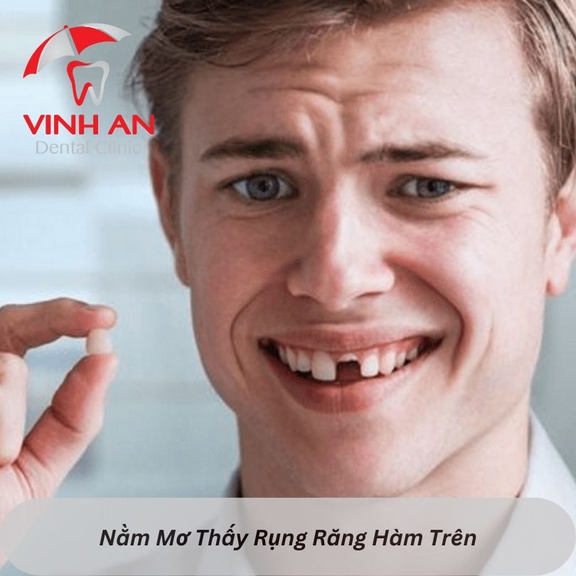 Mơ Rụng Hết Răng Đánh Con Gì? Gallery 2