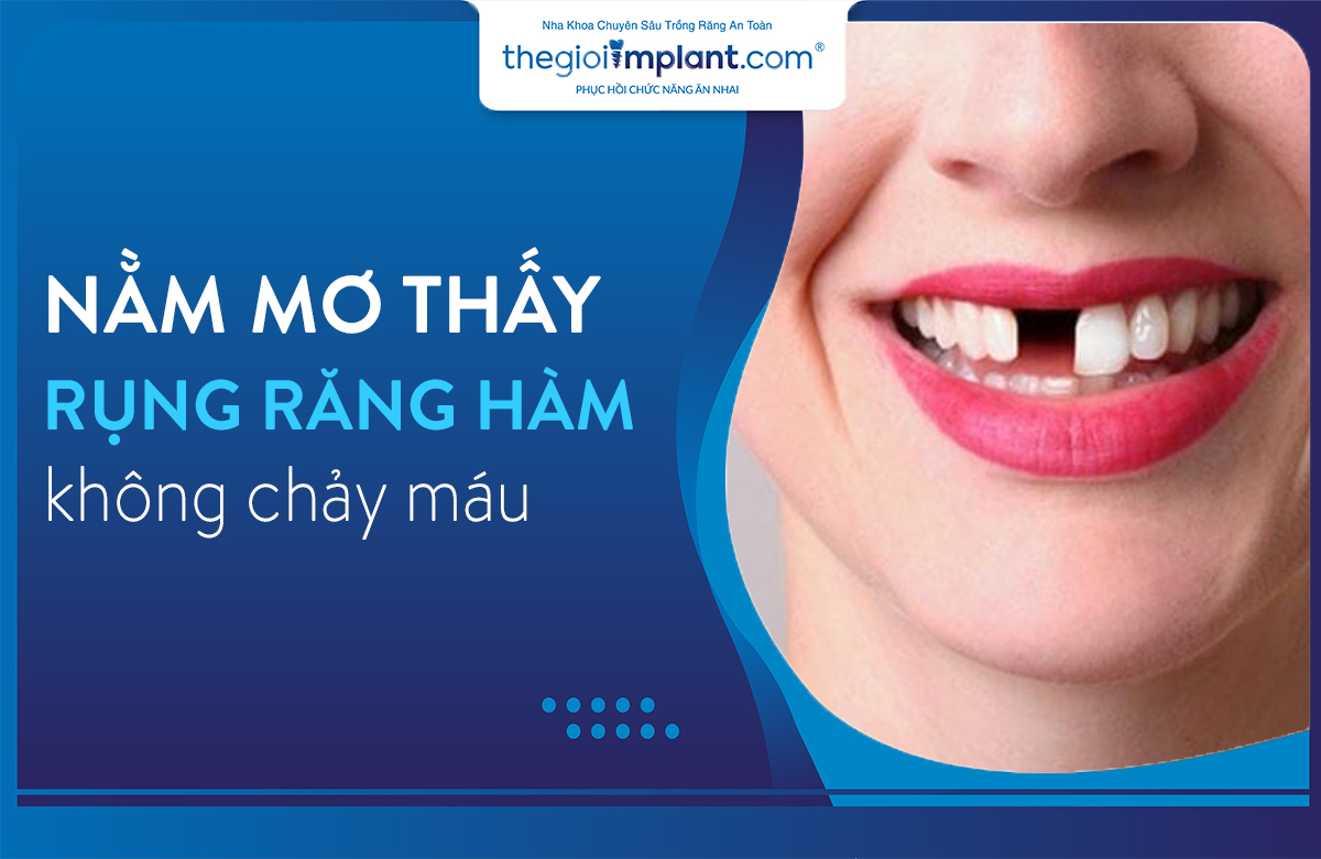 Mơ Rụng Răng Hàm Trên: Điềm Báo Gì? Giải Mã Giấc Mơ Chính Xác
