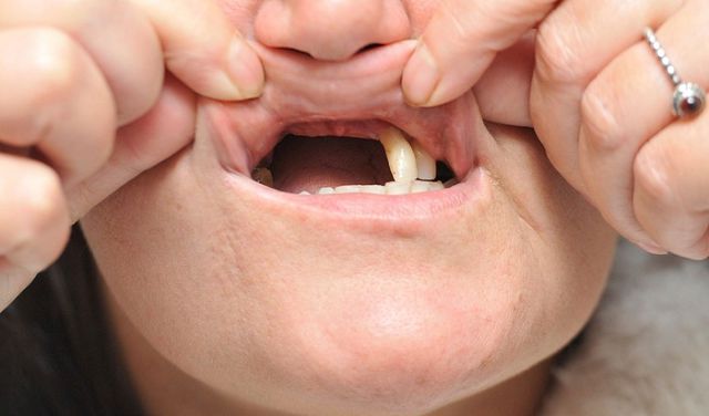 Mơ Rụng Răng Hàm Trên: Điềm Báo Gì? Giải Mã Giấc Mơ Chính Xác Gallery 2