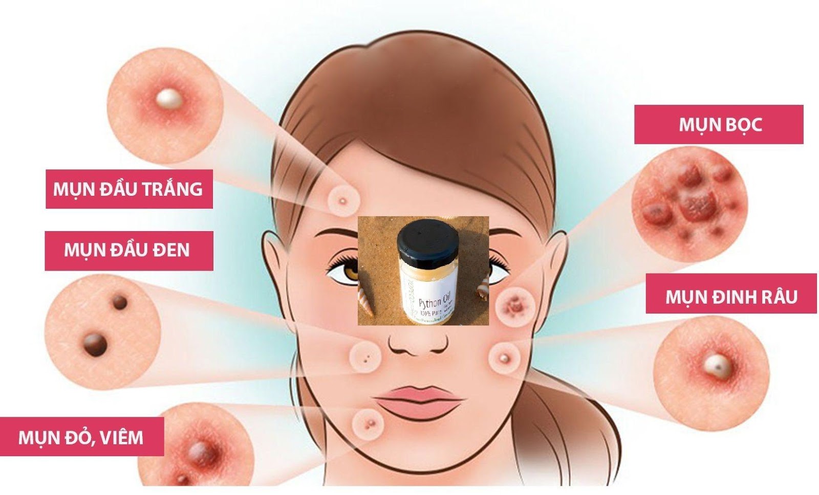 Mỡ Trăn Bôi Lên Mặt Được Không?