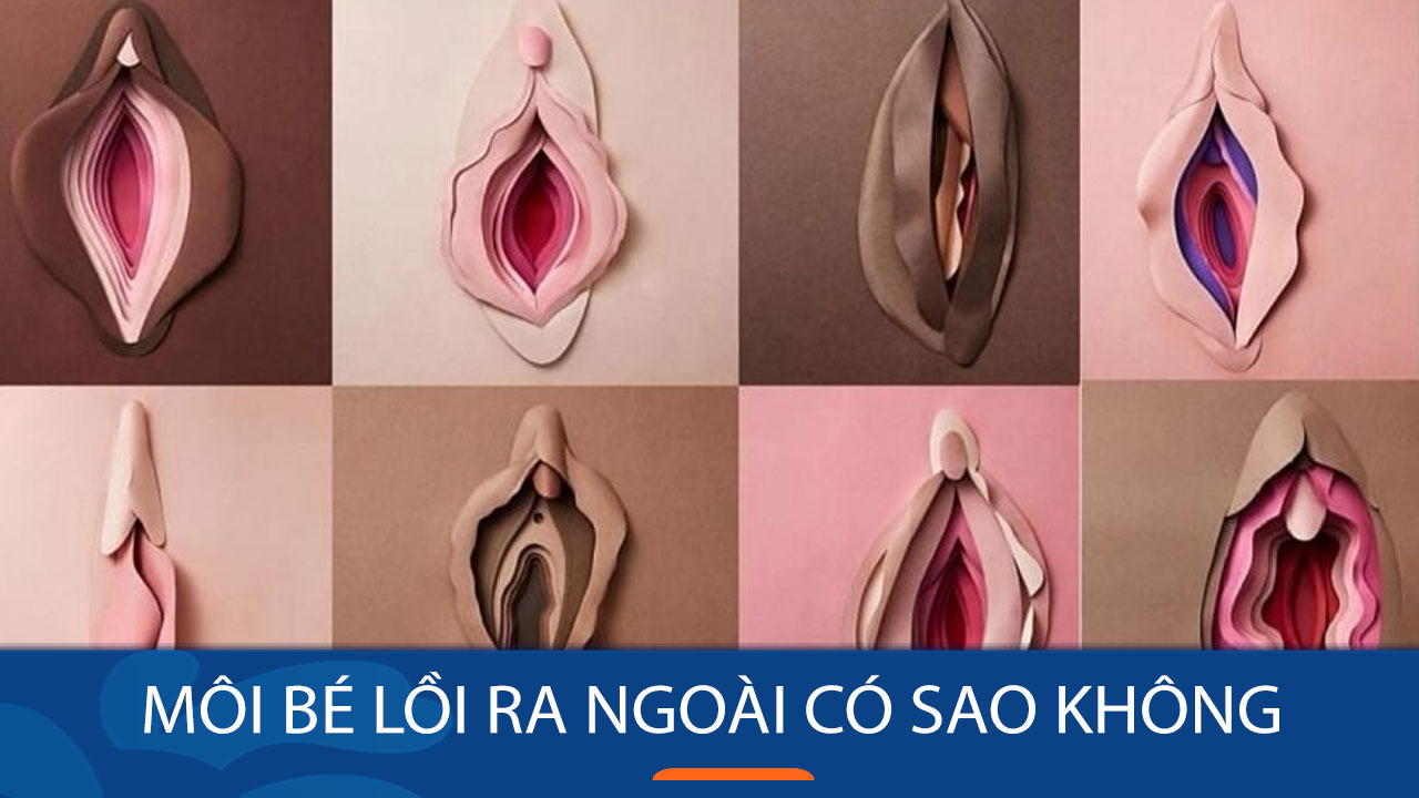 Môi Bé Lồi Ra Ngoài Có Sao Không?