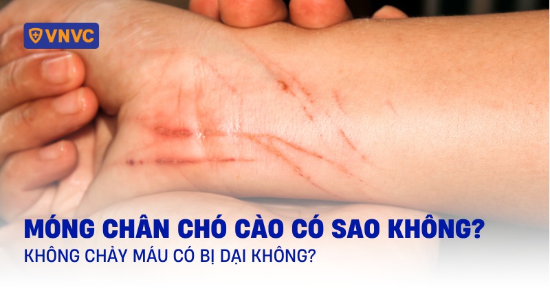 Móng Chân Chó Cào Có Sao Không?
