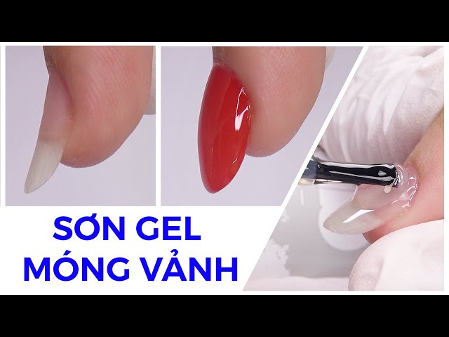 Móng Tay Bị Vểnh Lên: Nguyên Nhân Và Cách Khắc Phục