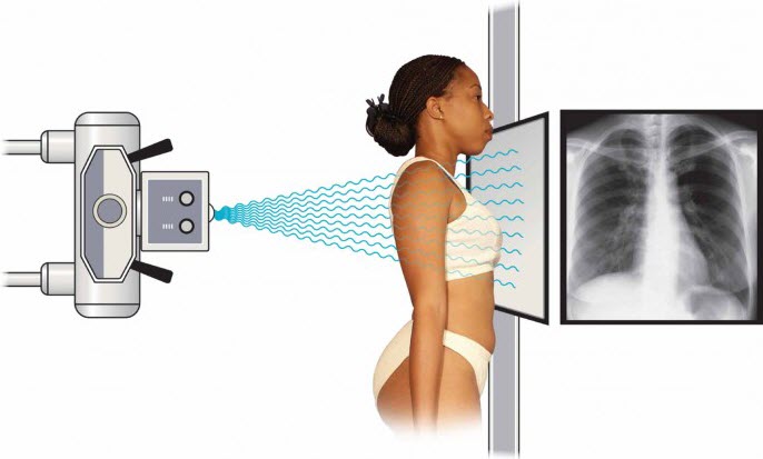 Ứng dụng của phóng xạ trong y học